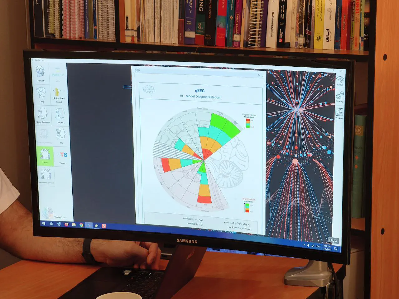 Brainovate AI laboratory setup